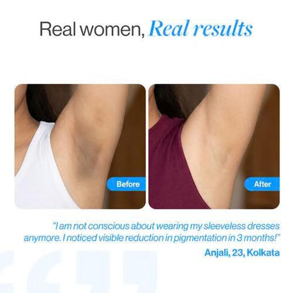 Bodywise 6% AHA BHA Underarm Roll-On – 75ml